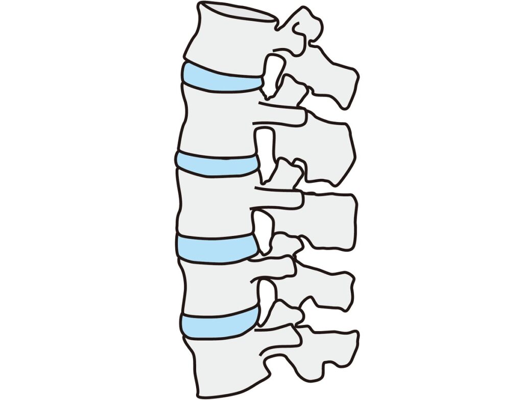 関節を捻挫している
