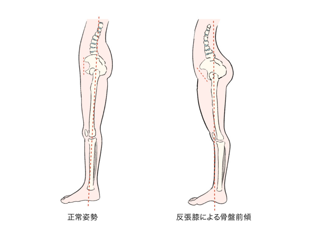 立つときはひざを少しだけ曲げる