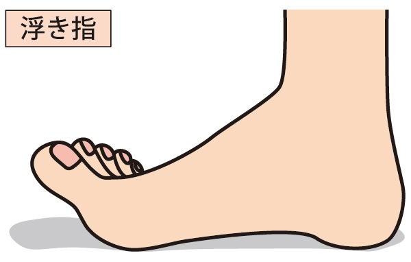 足の指をしっかり使えていない