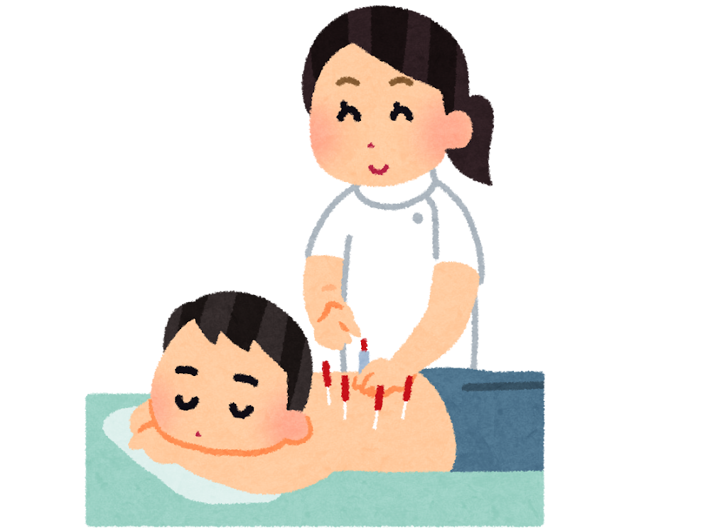 鍼灸のメリット